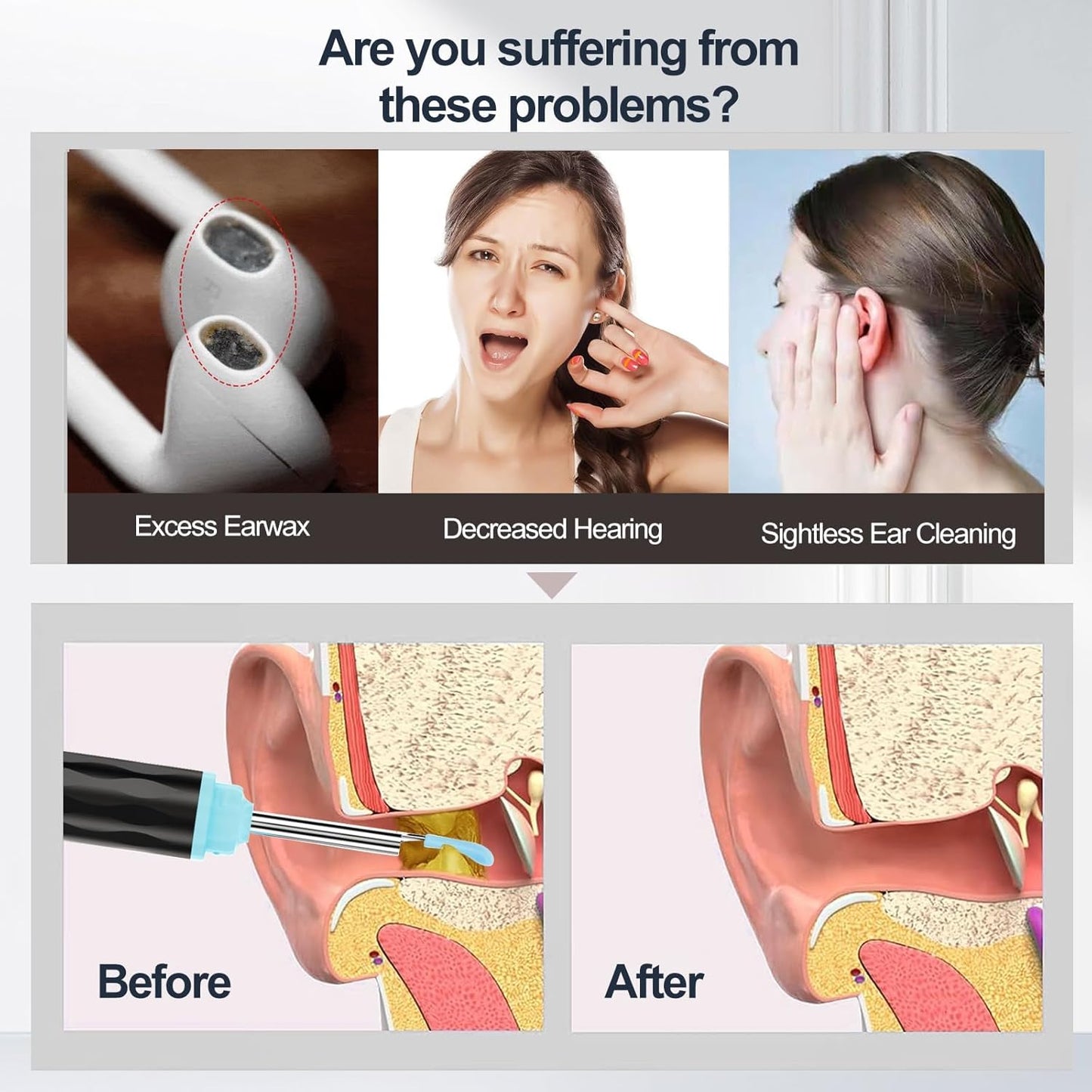 Smart Visual Ear Wax Cleaner